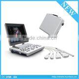 DICOM Port Color Doppler Ultrasound Machines 3d 4d for Sale thumbnail-2