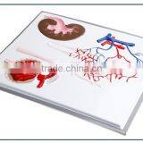 Nephron, Renal Corpuscle Model Demonstration Teaching Biological Science Instruments for Middle School Students thumbnail-2