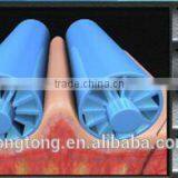 Latest Technology Vacuum Body Slimming Device With Cellulite Reduction and Body Shaping Functions thumbnail-5