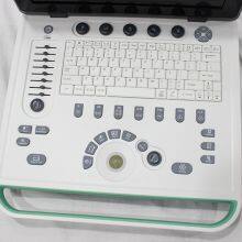 C5Mini Color Doppler Ultrasound System thumbnail-3