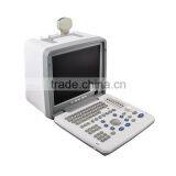 China Medical Ultrasonic Equipment pc Based Usb Ultrasound Scanner With Cheap Price thumbnail-4