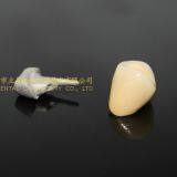 Dental Crown Porcelain Fused Metal, PFM, VMK, Dental Prostheses, Laboratoire Dentaire, Dentallabor, Laboratorio Dental, Dental Laboratory, Shenzhen LJ Dental Lab China thumbnail-5