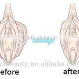 OEM Multifunction Clinical/medical/hospital Laser Vaginal Tightening Machine thumbnail-6