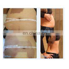 80K Cavitation Slimming Machine 80k Ultrasonic Cavitation Weight Loss Machine Vertical 80K Cavitation Ultrasonic Slimming thumbnail-5