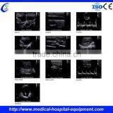 Ultrasound Linear Probe thumbnail-2