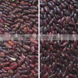 Ccd Camera Bean Color Sorter Price in China thumbnail-5