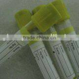 SST Tube(CE \ ISO13485 \ ISO9001)