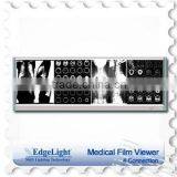 Edgelight Medical Light Viewer