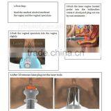 Fractional Laser for Skin Rejuvenation & Skin Tightening Laser Machine thumbnail-4