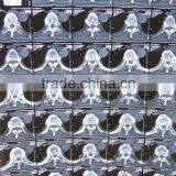 Imaging Medical Ray Film,digital X-ray Cr,fuji X-ray Film Sale From Factory thumbnail-1