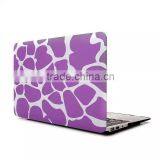 Plastic Crystal Hardshell Hard Case Cover For New Apple Mac Book thumbnail-3