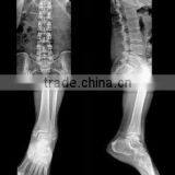 Konida Automatic Medical X-ray Film Agfa Fuji Dry Film thumbnail-3