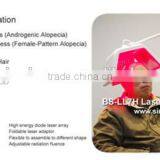 Laser Machine for Hair Restoration Laser Hair Regrowth Machine thumbnail-2