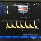 Популярный портативный цветной допплеровский ультразвуковой сканер медицинское оборудование для больниц thumbnail-5
