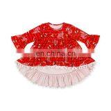 Hot Selling Baby Girl Fashion Top Dress Printed Floral Christmas Style High-low Top Pompom Dress Baby Clothes thumbnail-3