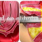 F7+ Co2 Laser Vaginal Rejuvenation Treatment / Co2 Laser Vaginal thumbnail-5