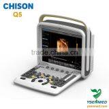 Top Brand Digital Portable Color Dopper CHISON Q5 Ultrasound Best Price