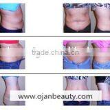 2016 Portable Lipo Laser Machine With Factory Price thumbnail-5