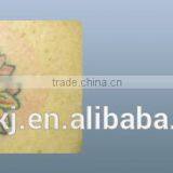 Fda Approval Nd:yag Laser Hair Removal Device/tattoo for Removal thumbnail-2