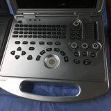 Portable 4D Color Doppler Ultrasound Scanner thumbnail-5