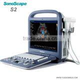 4D Portable Pregnancy Color Doppler Ultrasound Price thumbnail-6
