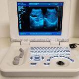 Ноутбук-тип черно-белый ультразвуковой сканер диагностического оборудования thumbnail-3