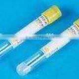 Vacuum Blood Tube---2mlSST Tube