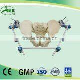 Pelvic External Fixator Orthopedic External Fixation