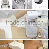 Best Design Ultrasound Leading Slimming Machine Liposonix Slimming for Sale thumbnail-3