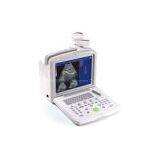 Portable Convex Ultrasound Scanner---CE Certified thumbnail-3