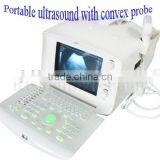 Promotion!!CE Approved Notebook USB Ultrasound Scanner With 3.5Mhz Multi-frequency Convex Probe RUS-6000A thumbnail-3