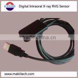 Ccd Digital Radiography System Dental Digital Sensor