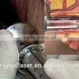 Sun Damage Recovery 2016 Best Sale Spot Scar Pigment Removal RF Fractional Co2 Laser Vaginal Tightening Machine thumbnail-5