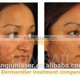 Zgts Derma Roller / Biogenesis Dns Derma Roller thumbnail-6