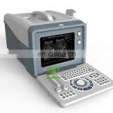 MY-A001A Laptop Full Digital Portable Ultrasound Scanner Mini Ultrasound Machine thumbnail-4