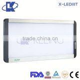 Hospital X-ray Film Viewing Machine X-LED.IIIT X-ray Film Viewing Machine Price