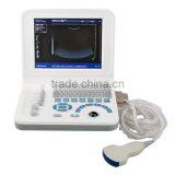 Full Digital Laptop B&W Ultrasound System Ultrasound Scanner Ultrasound Machine thumbnail-3
