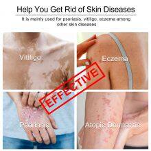 High Effective Solution 308nm Excimer Uvb Laser Vitiligo Treatment Device for Psoriasis and Vitiligo thumbnail-4