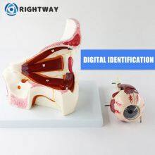 Офтальмологическая клиника. Демонстрация состояния роговицы глаза. Инструмент для демонстрации глаукомы человеческого глаза thumbnail-4