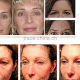 Factory Price High Quality Anti Wrinkle Facial Machine thumbnail-6