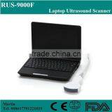 Portable Laptop Ultrasound Scanner With CE thumbnail-1