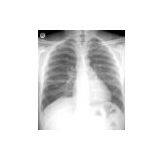 Meidcal Double-side Dry Film(CT-7) thumbnail-1