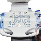 White+Bule Wholesale Medical Supplier Digital Ultrasound Machine for Pregnancy thumbnail-4