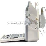 Популярный портативный цветной допплеровский ультразвуковой сканер медицинское оборудование для больниц thumbnail-4