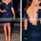 Blue Lace and Transparent Patchwork V-neck Women Mini Dresses Prom Vestidos Homecoming Dress JH-DR-940 thumbnail-1