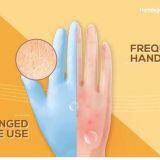 Disposable Medical Nitrile Gloves