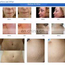 New Products 2 in 1 Current Good Price Skin Rejuvenation Microneedle Fractional Lose Weight Skin Tightening Machine thumbnail-3