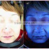 CE / ISO Approval Skin Scanner Analyzer Magic Analyzer Ostar Beauty SA 03 thumbnail-2