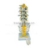 Life-size 5 Pcs Anatomical Lumbar Vertebra Model thumbnail-4