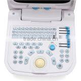 Beautiful Compact Diagnostic Ultrasound Probe / Mini Ultrasound Machine / Portable Ultrasound Scanner thumbnail-5